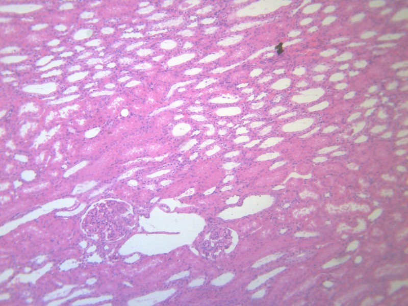 肾小管水肿 显微切片图片