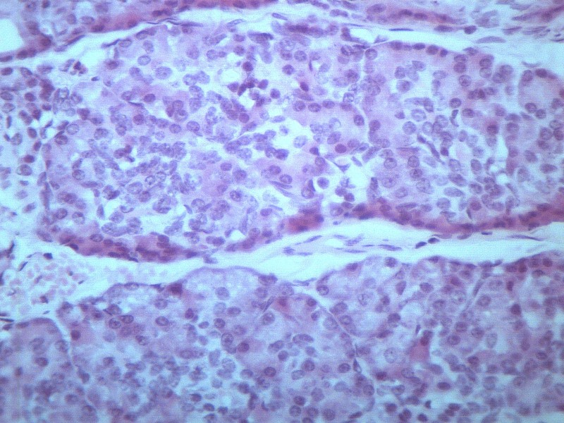 畸胎瘤 显微切片图片
