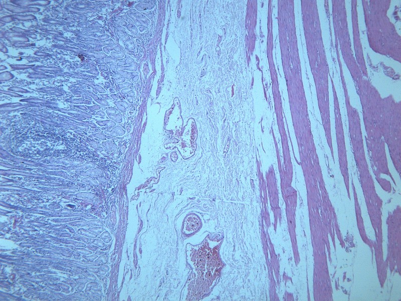 慢性萎缩性胃炎 显微切片图片