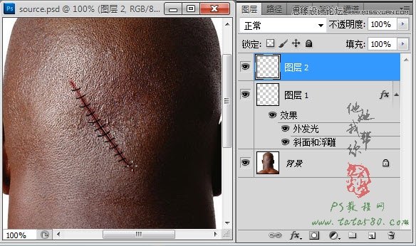 Photoshop合成人物缝合的伤口效果教程,52photoshop教程