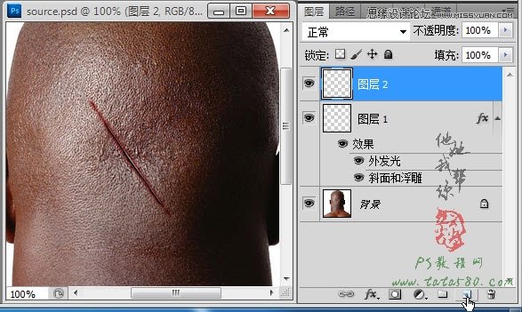 Photoshop合成人物縫合的傷口效果教程,52photoshop教程
