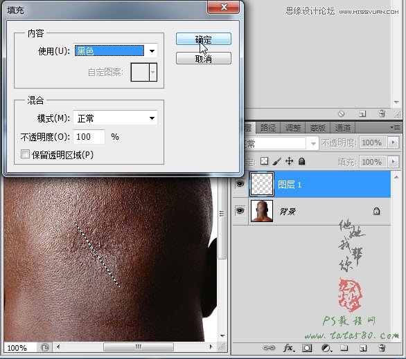 Photoshop合成人物缝合的伤口效果教程,52photoshop教程