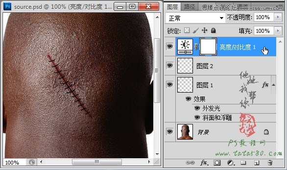 Photoshop合成人物缝合的伤口效果教程,52photoshop教程