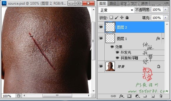 Photoshop合成人物缝合的伤口效果教程,52photoshop教程